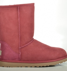 5 Reasons Why UGGs Are Ugly